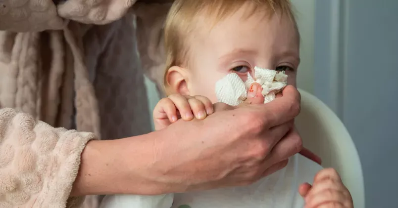 Ett litet barn får näsan torkad av en vuxen person. Bilden illustrerar vab och vård av sjukt barn.