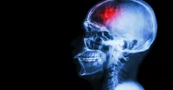 Puwadol Jaturawutthichai / Colourbox